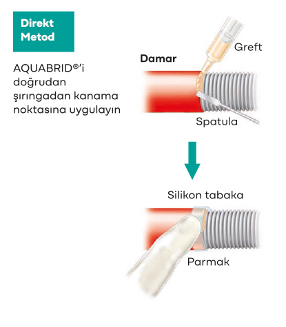 AQUABRID® - 0